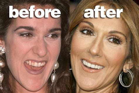 celine dion fake teeth|what did celine dion look like.